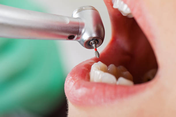 Best Knocked-Out Tooth Emergency  in St Joseph, MN